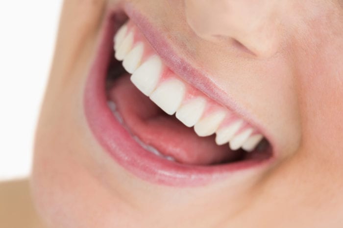 teeth whitening in hunt valley md